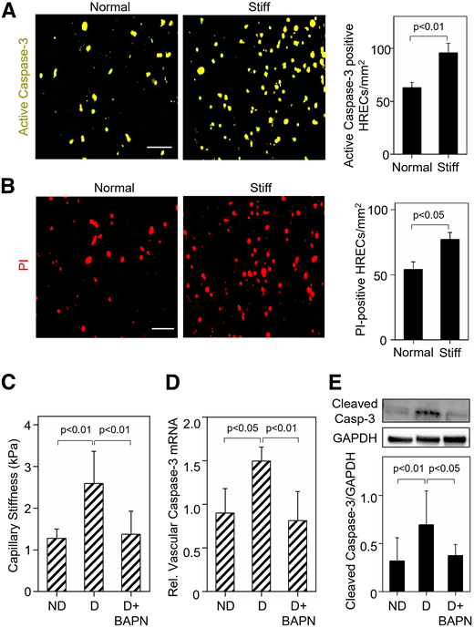 Retinal capillary stiffening exacerbates EC apoptosis associated with DR. Representative fluorescent images and quantitative analysis of HRECS treated with neutrophil elastase (50 nmol/L) for 12 h grown on normal (1 kPa) or stiff (2.5 kPa) synthetic matrices (n = 2–3/condition) for 48 h revealed that matrix stiffening significantly increases both HREC apoptosis (caspase-3 activity) (A) and necrosis (propidium iodide [PI] labeling) (B). C: Quantitative analysis of AFM force-indentation curves from ≥12 locations on the vasculature (n = 6/group) revealed that the approximately twofold increase (P < 0.01) in retinal vascular stiffness seen in longer-term D mice is almost completely blocked by LOX inhibitor BAPN. RT-qPCR analysis of unfixed mouse retinal vessels and Western blot analysis of whole mouse retinas (n = 6–8 mice/group) show that treatment of longer-term D mice with LOX inhibitor BAPN (3 mg/kg) prevents the diabetes-induced increase in both vascular caspase-3 mRNA expression (D) and retinal caspase-3 activity (E), respectively. Bars indicate mean ± SEM for in vitro data or mean ± SD for in vivo data.
