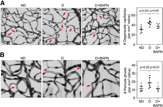 LOX-dependent stiffening promotes retinal capillary degeneration in diabetes. A and B: Representative images of elastase-digested retinal vessels and subsequent quantitative analysis revealed that the increased formation of degenerate (acellular) capillaries (indicated by arrows in A) and pericyte ghosts (indicated by arrows in B) in longer-term (30 weeks’ duration) D mice is significantly inhibited by blocking LOX-dependent capillary stiffening using BAPN (3 mg/kg). Scale bar: 25 µm (n = 8 mice/group).