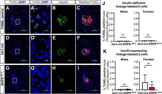 β-Cell death is not observed in islets from DHPSΔBETA mice. TUNEL assay was performed on pancreas tissue from 5-week-old TUNEL-positive control (tissue treated with DNase) (A–C), Ins1-cre (D–F), and DHPSΔBETA (G–I) mice to determine cell death (TUNEL, white). Scale bar: 100 µm. A’, D’, and G’: Higher magnification to visualize location of TUNEL. Scale bar: 10 µm. J: TUNEL+ insulin-deficient lineage-labeled (Tomato+) β-cells were counted (average TUNEL+ cells/insulin−Tomato+ cells: Ins1-cre males, 0/8,624; DHPSΔBETA males, 0/2,929; Ins1-cre females, 2.6/8,624; DHPSΔBETA females, 2.5/11,120). K: TUNEL+ insulin-expressing lineage-labeled (Tomato+) β-cells were counted (average TUNEL+ cells/insulin+Tomato+ cells: Ins1-cre males, 0/5,945; DHPSΔBETA males 0/9,489; Ins1-cre females, 0.6/3,782; DHPSΔBETA females, 0/7,109) (n = 3/group). Data are represented as mean ± SEM. ns, not significant.