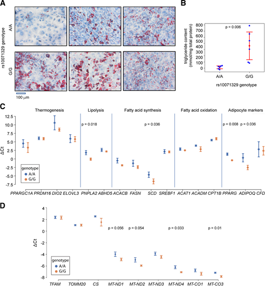rs10071329 alleles influence lipid accumulation and mitochondrial gene expression in hBA cells. A: rs10071329-edited A/A and G/G hBA cells were differentiated to brown adipocytes and stained with Oil Red O to assess lipid accumulation. Representative images are shown, and similar data were obtained in three independent experiments. B: Triglyceride content measured in cells differentiated as in A was measured by lipase-released glycerol quantification, normalized to total protein content (n = 3 clonal populations per genotype; data are from two independent experiments). P values are from the Student t test. C: Cells differentiated as in A were assessed by RT-qPCR for expression of x-axis–denoted genes involved in different brown adipocyte-relevant functions (denoted above the graph) (n = 3 clonal populations per genotype). P values are from the Student t test, only P < 0.05 are shown in the graph; similar data were observed in two independent differentiation experiments. D: rs10071329-edited A/A and G/G hBA cells were differentiated to brown adipocytes, and expression of the x-axis–denoted nuclear- and mitochondria-encoded (prefix MT) genes was measured using RT-qPCR. E: The cells were as in D, but here DNA was extracted, and the content of three different x-axis–denoted mitochondrial genes was assessed using qPCR. F: The cells were as in D, lysed in SDS, and the samples were immunoblotted for OXPHOS proteins. The graph below the blot shows quantified band intensity of each OXPHOS protein normalized to GAPDH. In all graphs, dots are mean values, and error bars are SDs (n = 3 clonal populations per genotype). P values are from the Student t test, P values <0.05 or with trending significance are printed in the graphs; similar data were observed in two independent differentiation experiments.