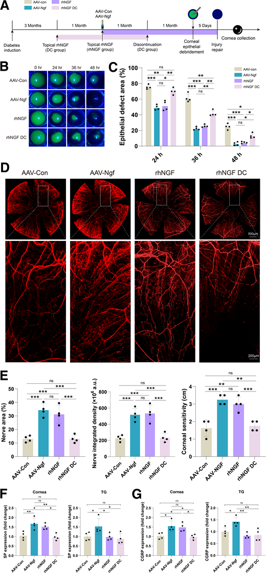 Sustained corneal nerve regeneration effects after a single injection of AAV-Ngf. A: Experimental design. Two months after AAV-Con, AAV-Ngf, and rhNGF treatment, mice underwent corneal epithelial debridement. For the rhNGF DC group, mice received rhNGF treatment of 2 months and discontinued for 1 month before epithelial debridement. Corneal epithelial repair and nerve regeneration were examined in all groups. B: AAV-Con and rhNGF DC showed delayed epithelial repair. n = 4. C: Quantitation of corneal epithelial defect area. AAV-Ngf and rhNGF showed comparable repair rates. n = 4. *P < 0.05, **P < 0.01, ***P < 0.001, ns, not significant. D: Corneal nerve regeneration in the repaired corneas. AAV-Ngf and rhNGF displayed effective nerve regeneration, while rhNGF DC lost the repair effects. n = 4. E: Quantification of nerve area, nerve density, and corneal sensitivity in all groups. rhNGF DC group had parameters similar to the AAV-Con group, indicating the treatment effect regression after 1-month discontinuation. n = 4. **P < 0.01, ***P < 0.001. F: The expression level of SP protein in corneal tissue significantly increased in both the AAV-Ngf and rhNGF groups. Additionally, the expression of CGRP protein in the TG was higher in the AAV-Ngf group compared with the other groups. n = 4. *P < 0.05, **P < 0.01. G: The expression level of CGRP protein in corneal tissue significantly increased in both the AAV-Ngf and rhNGF groups. The expression of SP protein in the TG was also higher in the AAV-Ngf group compared with the other groups. n = 4. *P < 0.05, **P < 0.01.