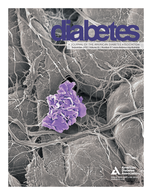 Diabetes Cover Image for Volume 61, Issue 9
