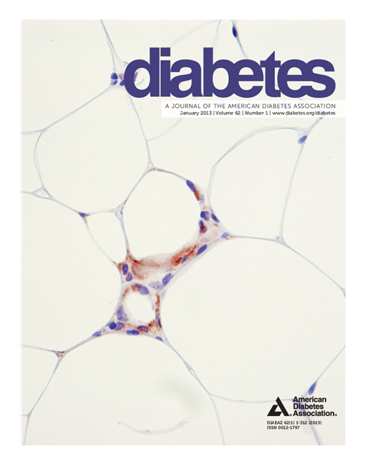 Diabetes Cover Image for Volume 62, Issue 1