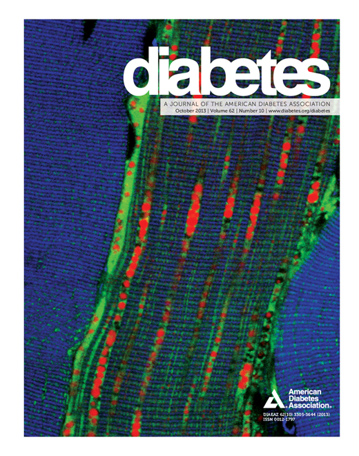 Diabetes Cover Image for Volume 62, Issue 10