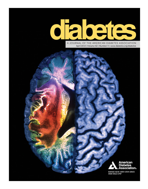 Diabetes Cover Image for Volume 62, Issue 4