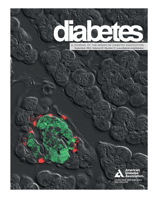 Diabetes Cover Image for Volume 63, Issue 9