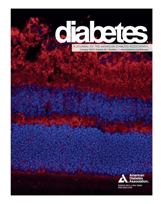 Diabetes Cover Image for Volume 65, Issue 1