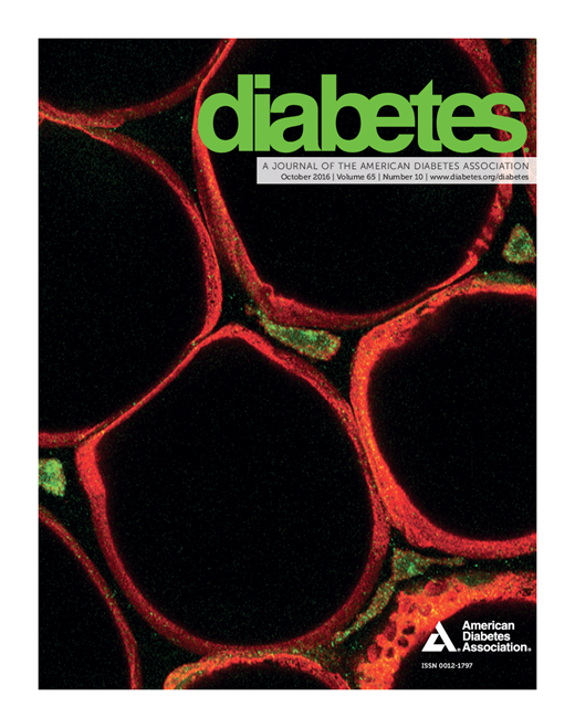 Diabetes Cover Image for Volume 65, Issue 10