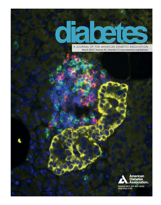 Diabetes Cover Image for Volume 65, Issue 3