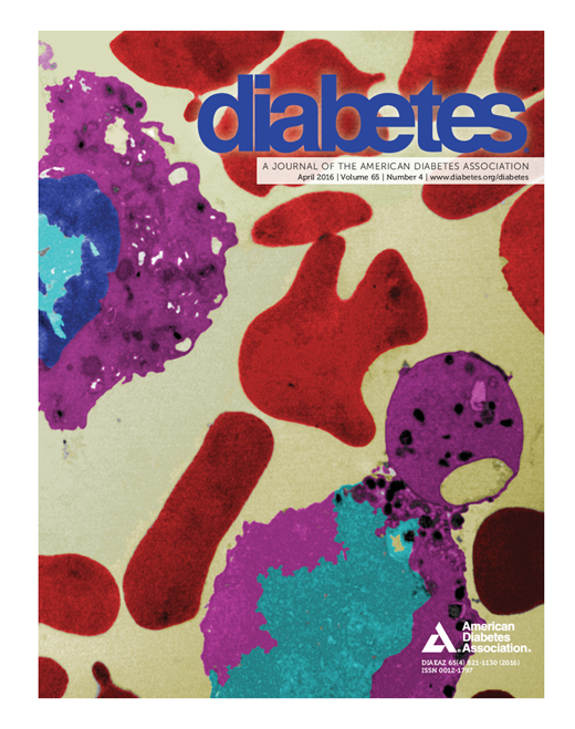 Diabetes Cover Image for Volume 65, Issue 4