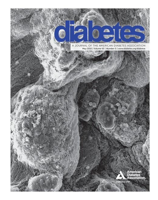 Diabetes Cover Image for Volume 65, Issue 5