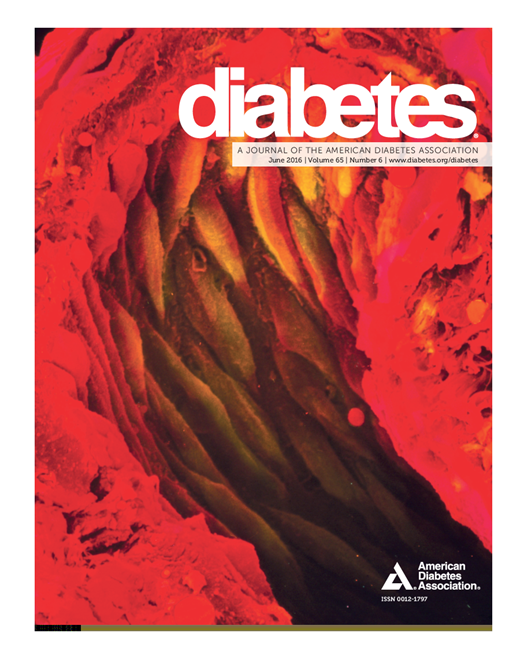 Diabetes Cover Image for Volume 65, Issue 6
