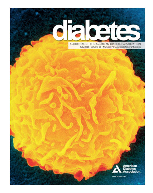 Diabetes Cover Image for Volume 65, Issue 7