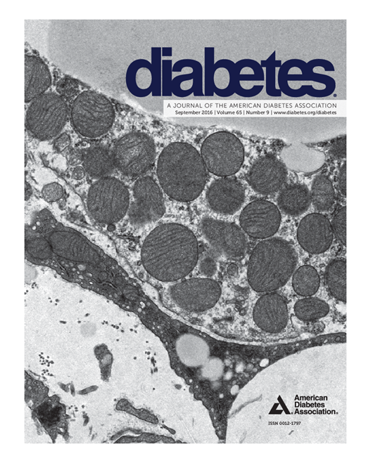 Diabetes Cover Image for Volume 65, Issue 9