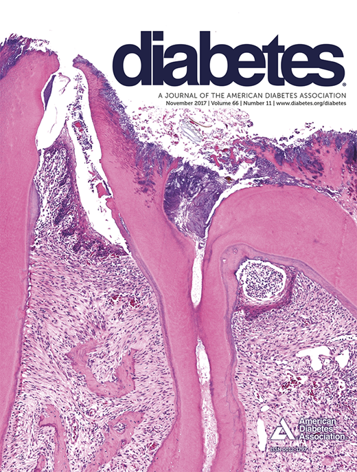 Diabetes Cover Image for Volume 66, Issue 11