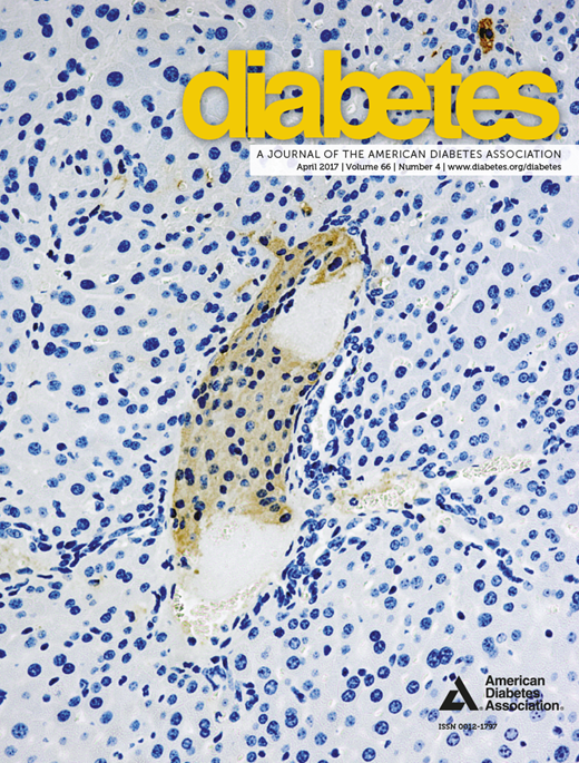 Diabetes Cover Image for Volume 66, Issue 4