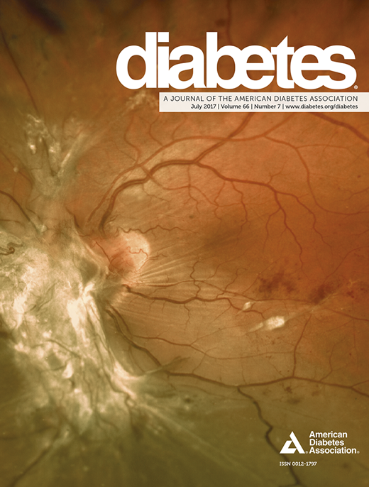 Diabetes Cover Image for Volume 66, Issue 7