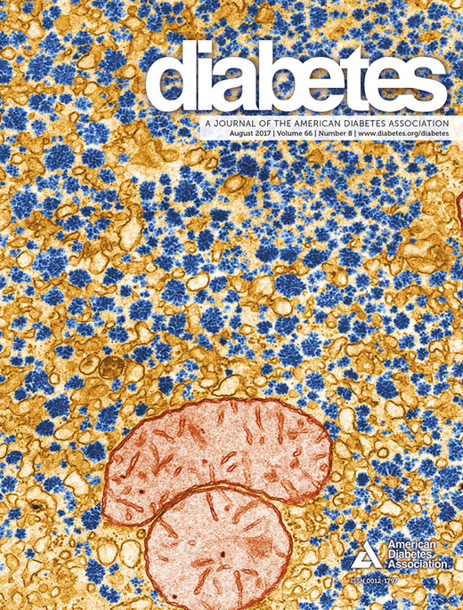 Diabetes Cover Image for Volume 66, Issue 8