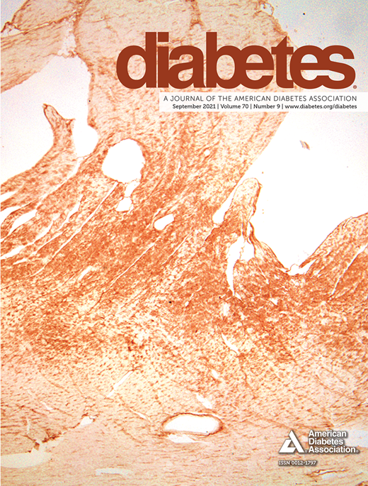 Diabetes Cover Image for Volume 70, Issue 9