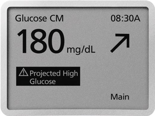 Figure 1. Receiver display illustrating real-time glucose value, trend arrow,and alarm. (Courtesy of Abbott Diabetes Care)