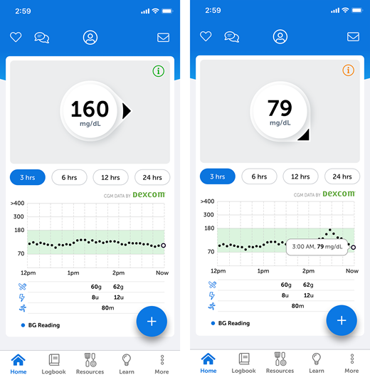 Sample screenshots of the IBC mobile app. The information icon (lowercase letter i within a circle) at the top right of the glucose value glows red when there is a message to the user that requires action. The user taps the plus icon (plus sign within a circle) to enter data and receive an insulin bolus dose recommendation.